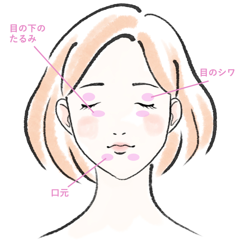 高周波治療で改善できる顔のたるみ・シワ