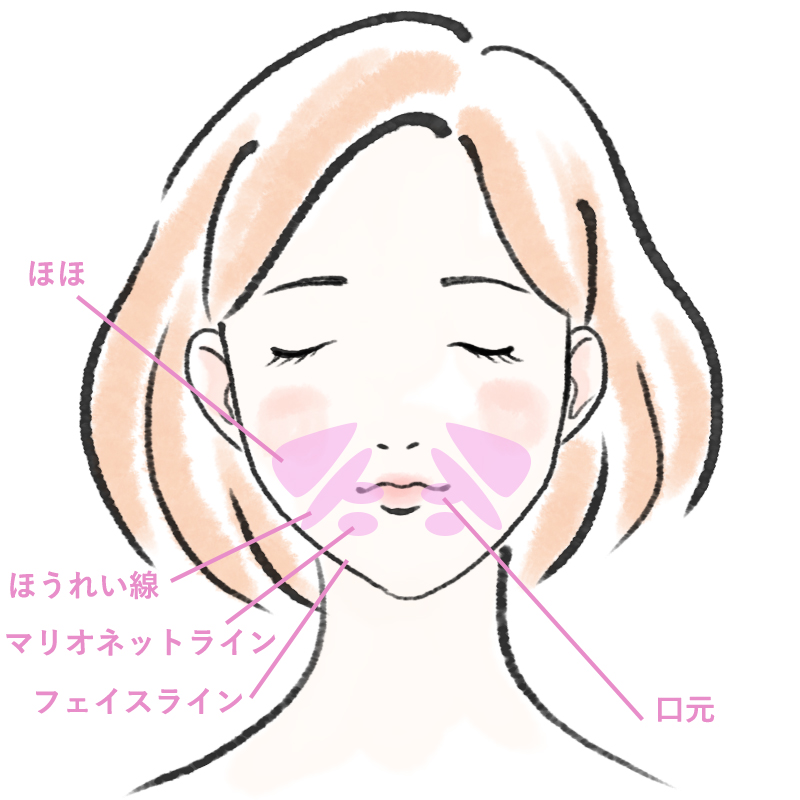 フェイスリフトの特徴